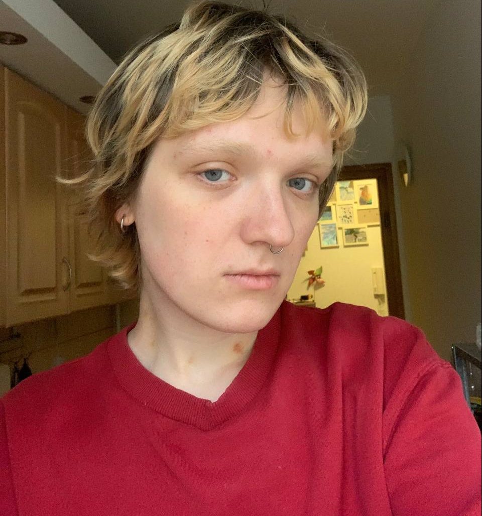 Як ЛГБТК+ людзям дапамагчы сабе ў момант крызісу